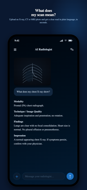 AI Radiologist chat reading a chest X-ray, with the answer structured into Modality, Technique and image quality, Findings and Impression